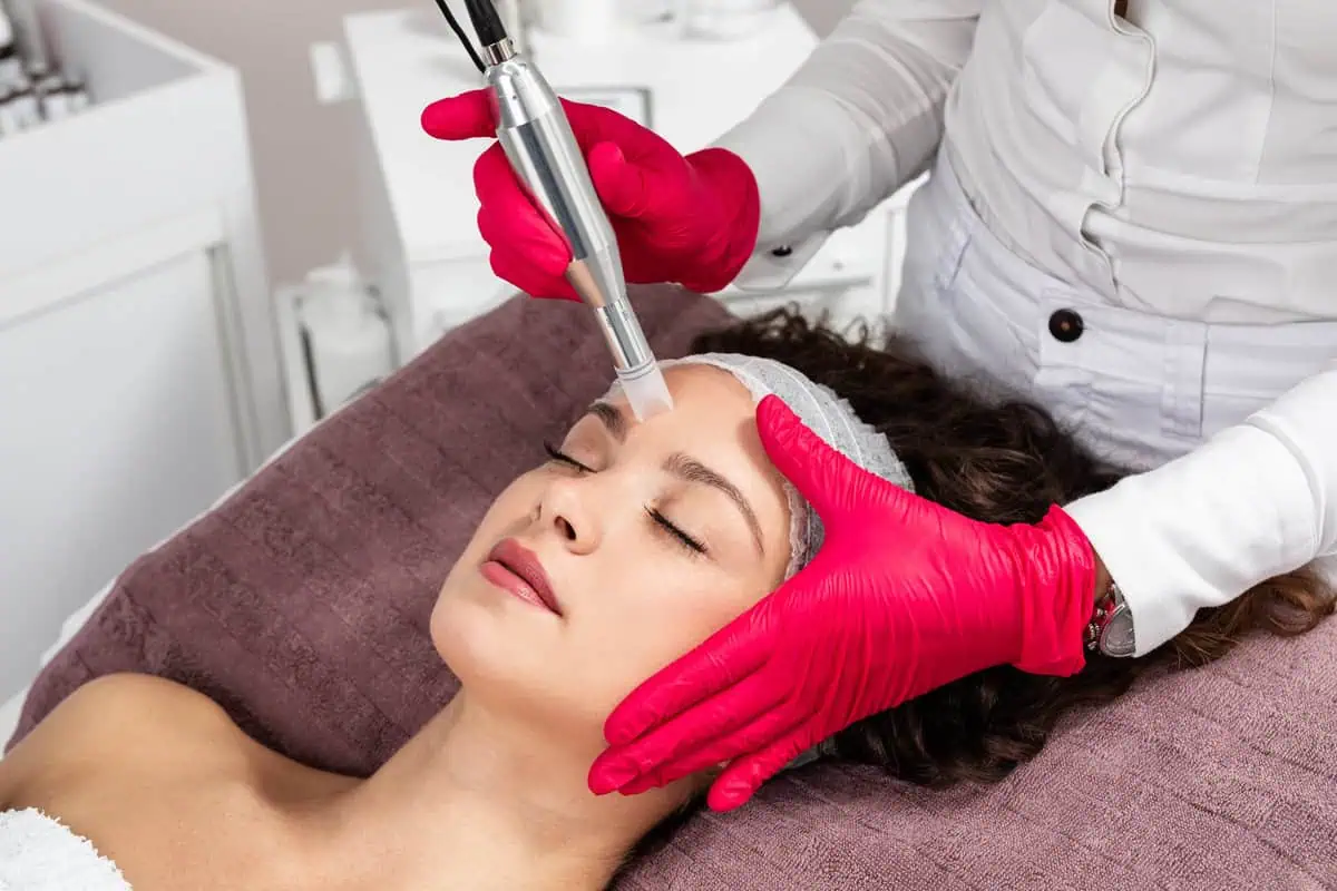 Microneedling Treatment in Flawless Medicine