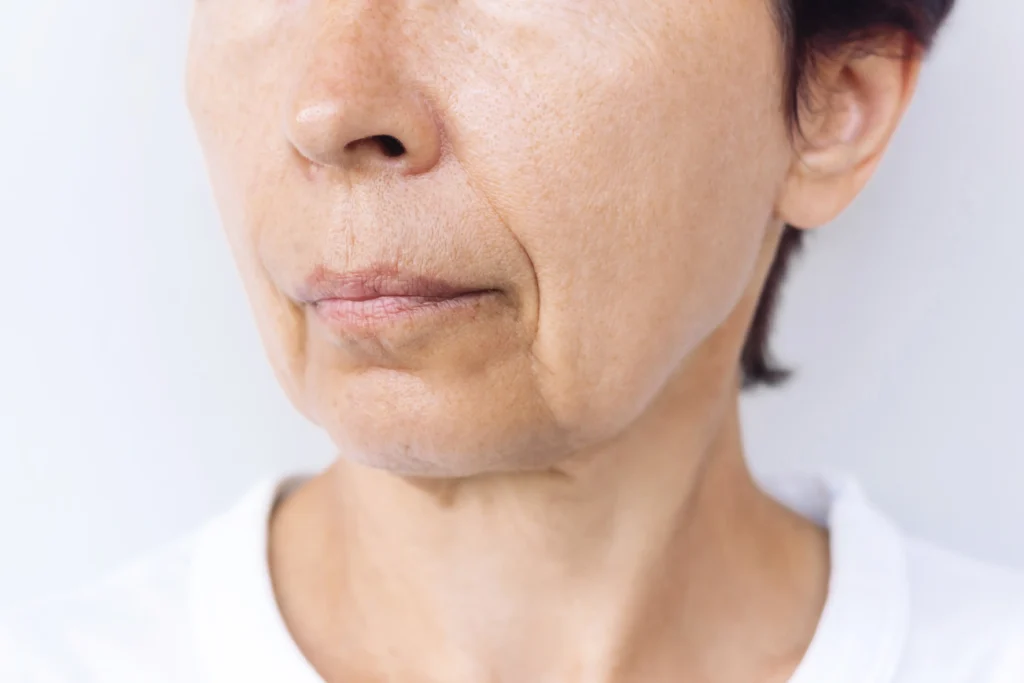Ellacor in Johnson City, TN | Flawless Medicine