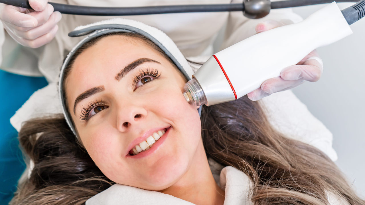 Woman receiving Microneedling Treatments at a clinic in Johnson City, TN