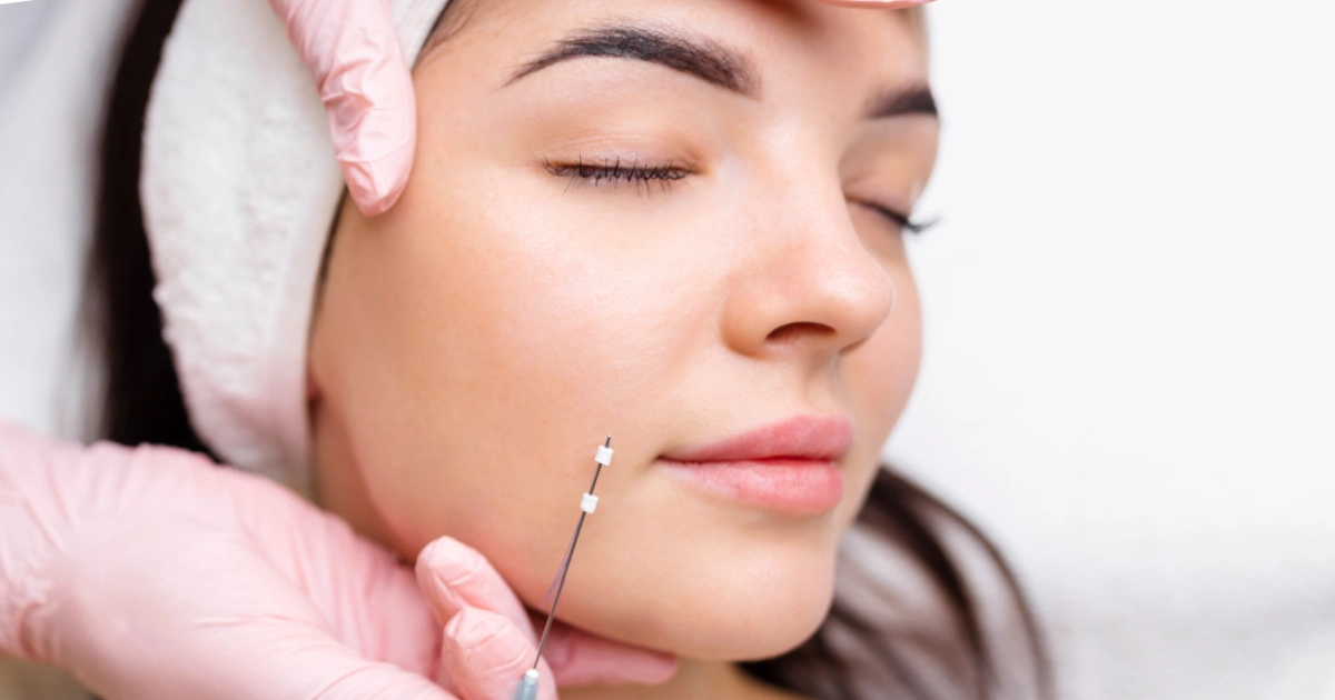Close-up of a woman getting a cheek thread treatment by a practitioner in pink gloves, highlighting PDO Threads in Johnson City, TN.