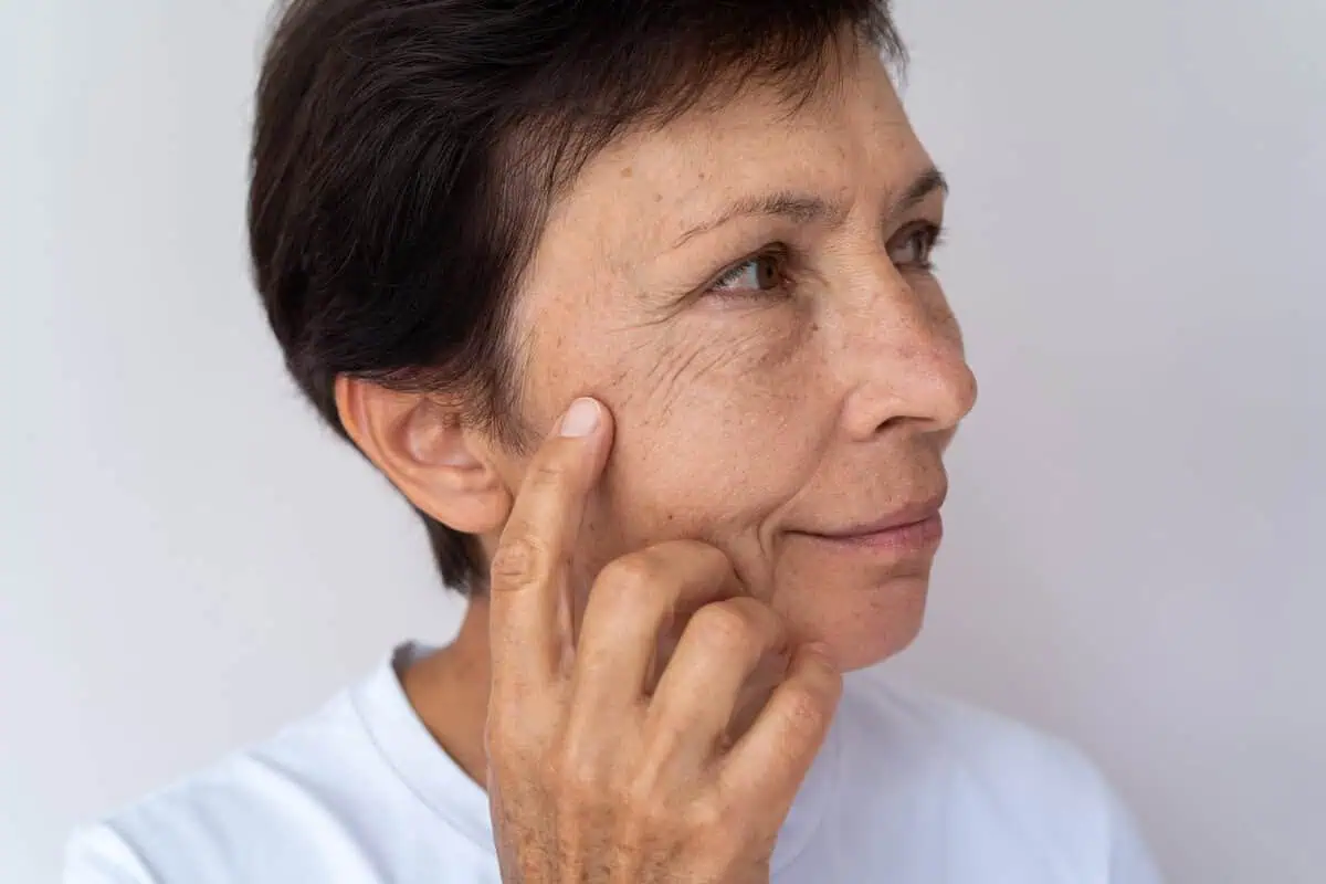 Flawless Medicine Ellacor treatment for loose skin and facial laxity in Johnson City, TN