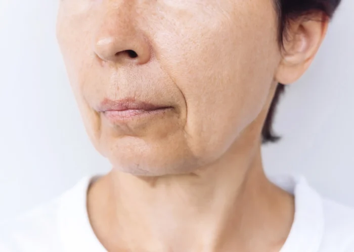 Ellacor in Johnson City, TN | Flawless Medicine