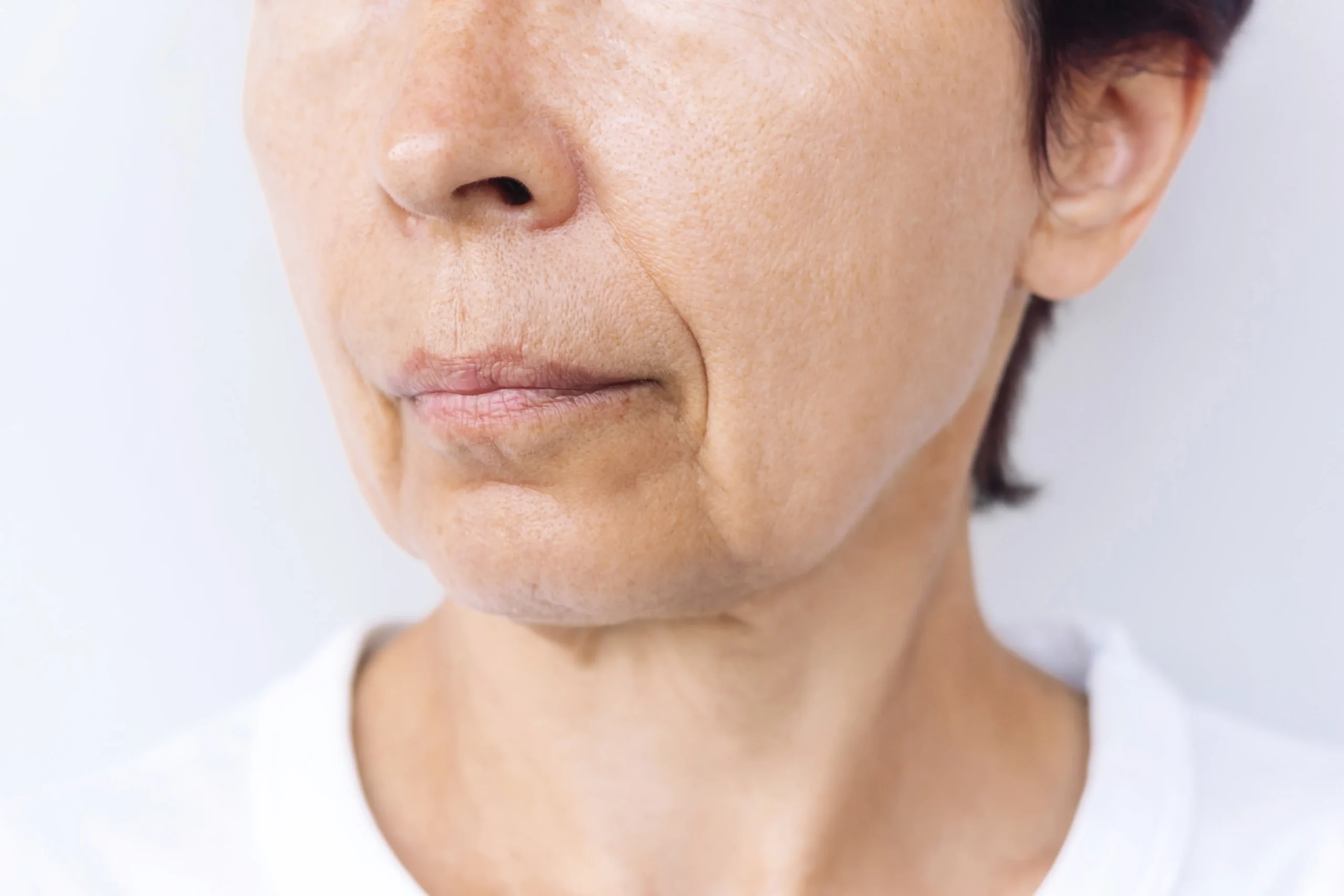 Ellacor in Johnson City, TN | Flawless Medicine